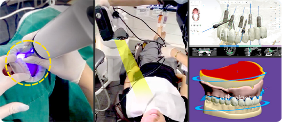더나은치과의 컴퓨터 분석 임플란트란?