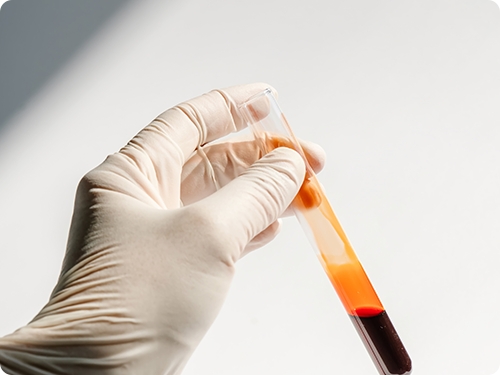 자가혈 PRF 임플란트 시술 과정 3단계